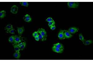 Immunofluorescence staining of HepG2 cells with ABIN7144938 at 1:166, counter-stained with DAPI. (ABCG5 Antikörper  (AA 1-127))