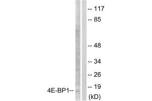 Western blot analysis of extracts from Jurkat cells, treated with Insulin (0. (eIF4EBP1 Antikörper  (Ser65))