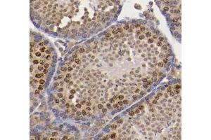 Immunohistochemistry analysis of paraffin-embedded mouse testis using CNOT8 (ABIN7073363) at dilution of 1: 800 (CNOT8 Antikörper)