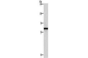 Western Blotting (WB) image for anti-Thyroid Hormone Receptor Interactor 4 (TRIP4) antibody (ABIN2429536) (TRIP4 Antikörper)