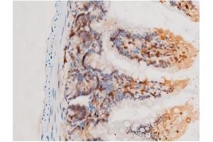 Immunohistochemistry (IHC) image for anti-Spleen tyrosine Kinase (SYK) (pTyr525) antibody (ABIN6255944)