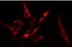ABIN6274177 staining HuvEc cells by IF/ICC. (PFKFB1 Antikörper  (C-Term))