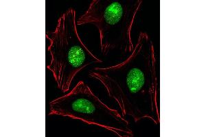 Fluorescent image of Hela cells stained with XAF1 PTK2B Antibody (C-term) (ABIN6243517 and ABIN6577462). (PTK2B Antikörper  (C-Term))