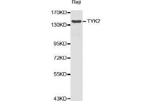 Western blot analysis of extracts of Raji cell lines, using TYK2 antibody. (TYK2 Antikörper  (AA 750-850))