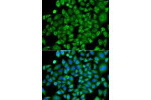 Immunofluorescence (IF) image for anti-N(alpha)-Acetyltransferase 50, NatE Catalytic Subunit (NAA50) (AA 1-169) antibody (ABIN6144326)