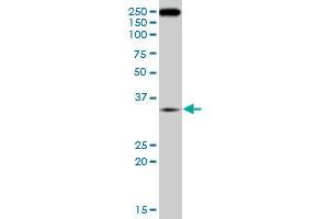 RNF2 monoclonal antibody (M09), clone 4A12. (RNF2 Antikörper  (AA 192-290))