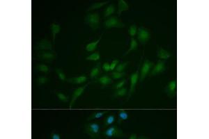 Immunofluorescence analysis of MCF-7 cells using LIG1 Polyclonal Antibody (LIG1 Antikörper)