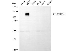 Western blotting analysis using CARD14 antibody (ABIN7797916).