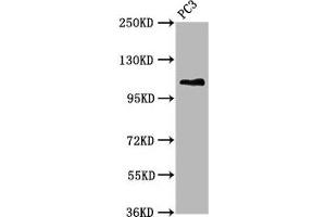 Western Blot Positive WB detected in: PC-3 whole cell lysate All lanes: FAN1 antibody at 5. (FAN1 Antikörper  (AA 167-373))