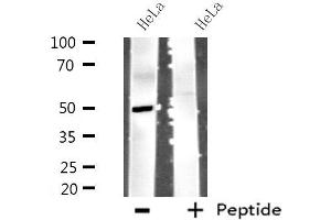 Western blot analysis of extracts from HeLa cells using MYLIP antibody. (MYLIP Antikörper  (Internal Region))
