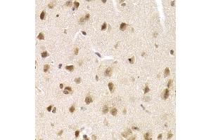 Immunohistochemistry of paraffin-embedded mouse brain using MCM4 Antibody (ABIN5971548) at dilution of 1/200 (40x lens). (MCM4 Antikörper)