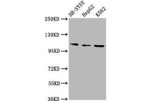 Western Blot Positive WB detected in: SH-SY5Y whole cell lysate, HepG2 whole cell lysate, K562 whole cell lysate All lanes: ULK2 antibody at 2. (ULK2 Antikörper  (AA 211-276))