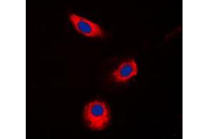 Immunofluorescent analysis of Aldose Reductase staining in Jurkat cells. (AKR1B1 Antikörper  (C-Term))