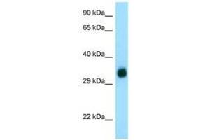 Image no. 1 for anti-gamma-Glutamyl Hydrolase (Conjugase, Folylpolygammaglutamyl Hydrolase) (GGH) (C-Term) antibody (ABIN6749781)