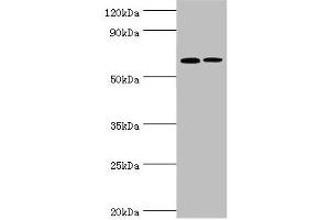 Western blot All lanes: IL27RA antibody at 9 μg/mL Lane 1: Rat heart tissue Lane 2: Rat brain tissue Secondary Goat polyclonal to rabbit IgG at 1/10000 dilution Predicted band size: 69 kDa Observed band size: 69 kDa
