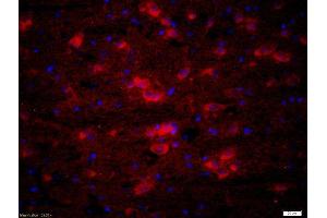 Formalin-fixed and paraffin-embedded rat brain labeled with Rabbit Anti-ATX2 Polyclonal Antibody, Unconjugatedused at 1:200 dilution for 40 minutes at 37°C.