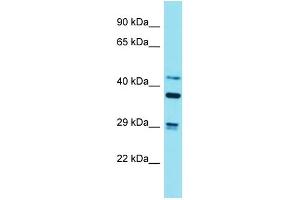 Western Blotting (WB) image for anti-Striatin, Calmodulin Binding Protein 3 (STRN3) (N-Term) antibody (ABIN2789947) (STRN3 Antikörper  (N-Term))