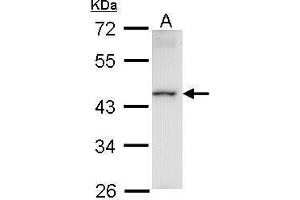 WB Image Sample (30 ug of whole cell lysate) A: Raji 10% SDS PAGE antibody diluted at 1:1000 (HMBOX1 Antikörper)