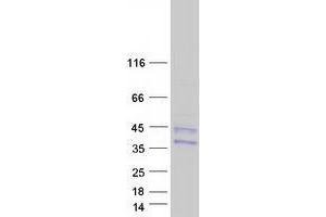 Western Blotting (WB) image for Transmembrane Protein 27 (TMEM27) protein (Myc-DYKDDDDK Tag) (ABIN2733890)
