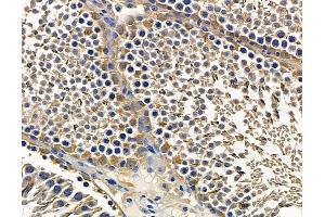 ABIN7096853 and ABIN7100919 at 1/100 staining rat testis tissue by IHC-P. (TOM1L1 Antikörper)