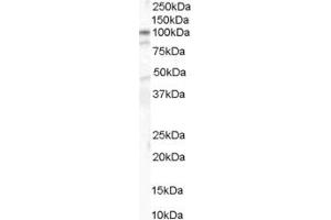 Western Blotting (WB) image for anti-CD209 (CD209) (C-Term) antibody (ABIN2775488) (DC-SIGN/CD209 Antikörper  (C-Term))
