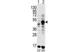 Western Blotting (WB) image for anti-Growth Differentiation Factor 9 (GDF9) antibody (ABIN3001444) (GDF9 Antikörper)