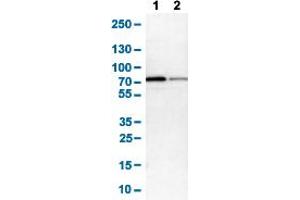 Western Blot analysis of (1) NIH-3T3 cell lysate (Mouse embryonic fibroblast cells), and (2) NBT-II cell lysate (Rat Wistar bladder tumour cells). (Glucose-6-Phosphate Dehydrogenase Antikörper  (AA 43-154))