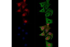 Phospho-JIP1 (Thr205) Antibody staining Hela cells(heat shock treatment) by IF/ICC. (MAPK8IP1 Antikörper  (pThr205))