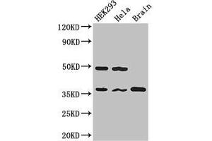 Western Blot Positive WB detected in: HEK293 whole cell lysate, Hela whole cell lysate, Mouse brain tissue All lanes: PPP1CC antibody at 2. (PPP1CC Antikörper  (Catalytic Subunit))