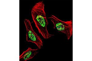 Fluorescent confocal image of Hela cell stained with NR2C2 Antibody . (TR4 Antikörper  (C-Term))