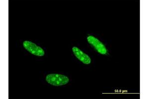 Immunofluorescence of monoclonal antibody to CSNK2A2 on HeLa cell. (CSNK2A2 Antikörper  (AA 1-350))