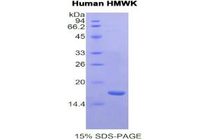 SDS-PAGE analysis of Human HMWK Protein.