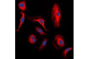 Immunofluorescent analysis of WNT1 staining in H9C2 cells. (WNT1 Antikörper  (C-Term))