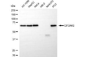 Western blotting analysis using EIF2AK2 antibody (ABIN7798507).