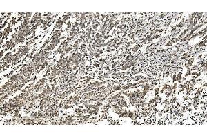 IHC analysis of HNRNPH3 using anti-HNRNPH3 antibody (ABIN7601121).