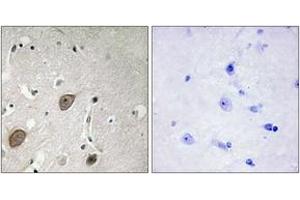 Immunohistochemistry (IHC) image for anti-Brain-Enriched Guanylate Kinase-Associated (BEGAIN) (AA 511-560) antibody (ABIN2889742) (BEGAIN Antikörper  (AA 511-560))