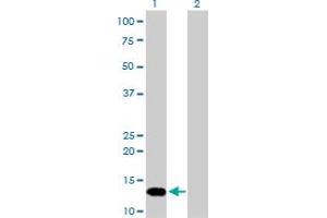 Western Blot analysis of FKBP1A expression in transfected 293T cell line by FKBP1A monoclonal antibody (M01), clone 1E5-A12. (FKBP1A Antikörper  (AA 1-108))