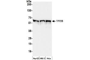 Western Blotting (WB) image for anti-Transcription Factor EB (TFEB) (AA 426-476) antibody (ABIN7450814) (TFEB Antikörper  (AA 426-476))