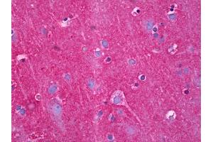 Anti-NDRG4 antibody IHC of human brain, cortex neuropil. (NDRG4 Antikörper  (AA 1-340))