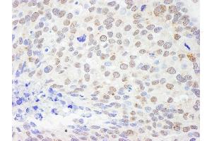 anti-DEAD (Asp-Glu-Ala-Asp) Box Polypeptide 1 (DDX1) (AA 500-550) antibody