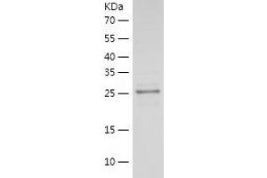 Western Blotting (WB) image for Laminin, alpha 5 (LAMA5) (AA 3401-3692) protein (His tag) (ABIN7123713) (Laminin alpha 5 Protein (AA 3401-3692) (His tag))