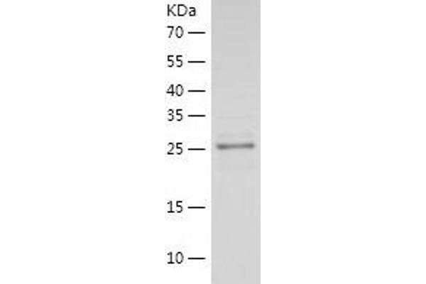 Laminin alpha 5 Protein (AA 3401-3692) (His tag)