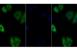 Detection of IL27Ra in Human MCF7 cell using Polyclonal Antibody to Interleukin 27 Receptor Alpha (IL27Ra) (IL27 Receptor alpha Antikörper  (AA 93-273))