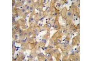 Immunohistochemistry analysis in human liver tissue (Formalin-fixed, Paraffin-embedded) using SPACA5 Antibody , followed by peroxidase conjugation of the secondary antibody and DAB staining.