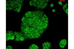 Immunocytochemistry/Immunofluorescence analysis using Mouse Anti-CD74 Monoclonal Antibody, Clone PIN 1. (CD74 Antikörper)