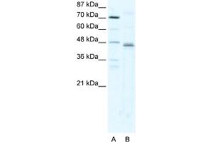 WB Suggested Anti-ZFP1 Antibody Titration:  2. (Zfp-1 Antikörper  (N-Term))