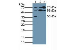 Western blot analysis of (1) Human Liver Tissue, (2) Human HeLa cells and (3) Rat Serum. (Butyrylcholinesterase Antikörper  (AA 29-150))