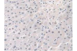 Detection of STX1A in Human Liver Tissue using Polyclonal Antibody to Syntaxin 1A, Brain (STX1A) (STX1A Antikörper  (AA 1-255))