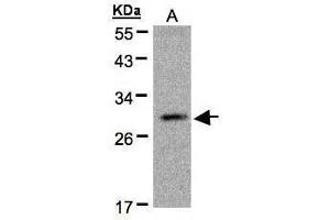 WB Image Sample(30 μg of whole cell lysate) A:MOLT4, 12% SDS PAGE antibody diluted at 1:500 (Kallikrein 2 Antikörper)