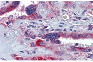 Immunohistochemistry with Human Placenta lysate tissue at an antibody concentration of 5. (GTPBP10 Antikörper  (Middle Region))